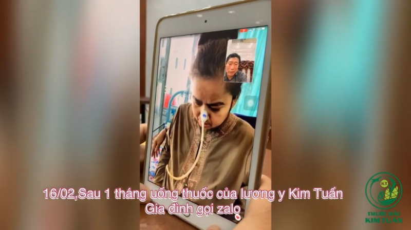 LUPUS BAN ĐỎ CHẾT NÃO - SỐNG THỰC VẬT, BỆNH VIỆN TRẢ VỀ