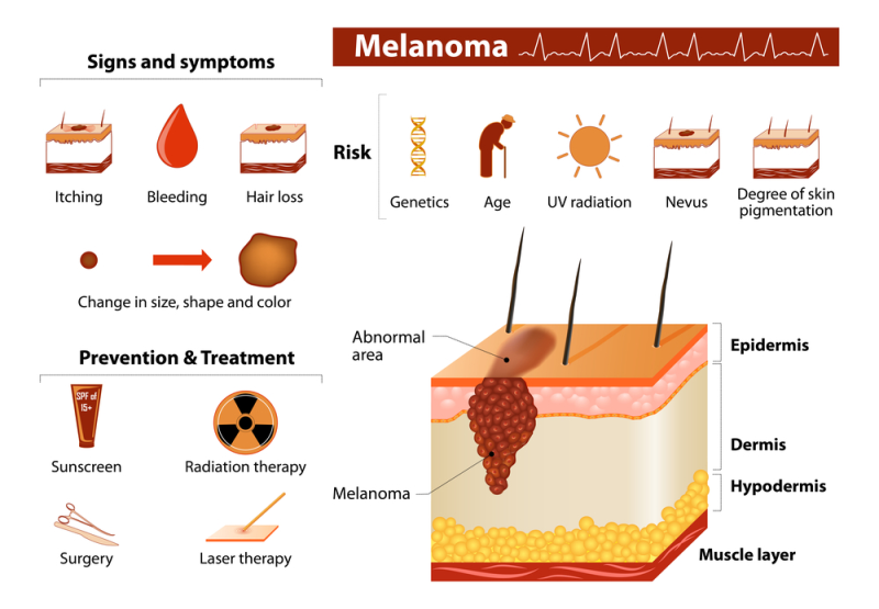 MELANIN VÀ RỐI LOẠN TĂNG SẮC TỐ DA: NÁM, TÀN NHANG, ĐỐM NÂU,…