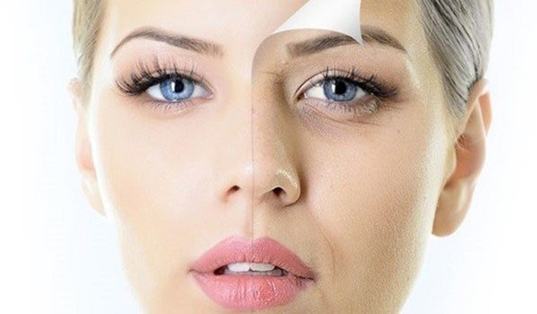 QUẦN THÂM MẮT - Điều trị bằng tân châm