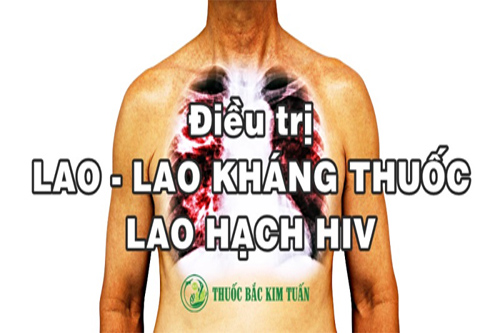 LAO - LAO KHÁNG THUỐC -  HIV LAO HẠCH